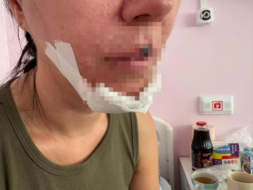 Просьба откликнуться девочек, оказавших помощь пострадавшей от самоката женщины в Волжском