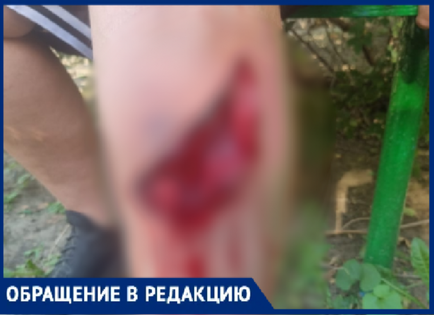 «Радуга смерти»: ребенок разорвал ногу до кости на детской площадке в Волжском