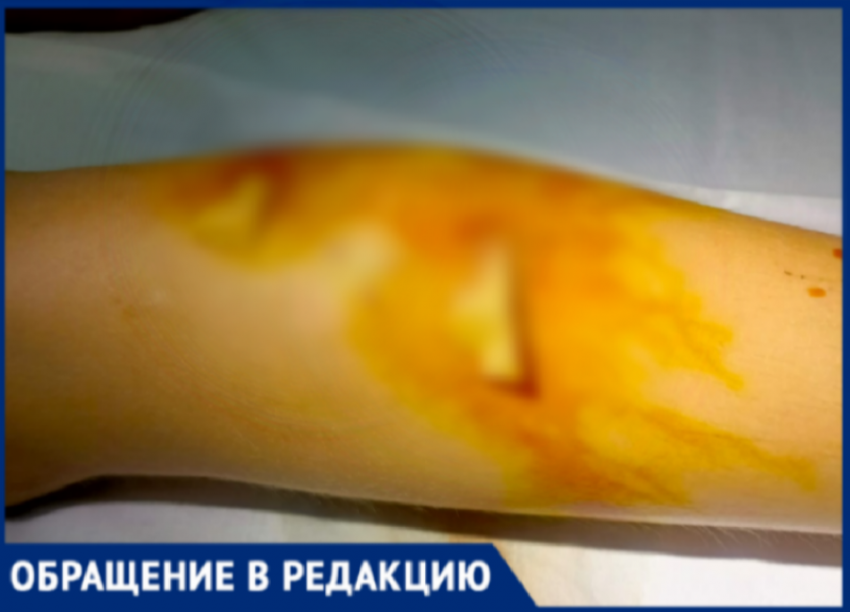 «Бросили ребенка, не оказав помощи»: волжанка ищет свидетелей нападения собаки на ее сына