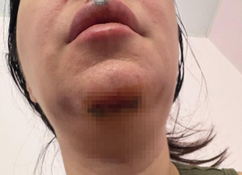 В Волжском возбуждено первое уголовное дело с электросамокатом: личность девочки установлена
