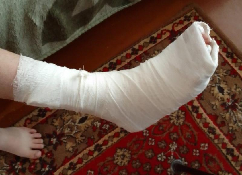 10-летний мальчик сломал ногу на детской площадке под Волжским